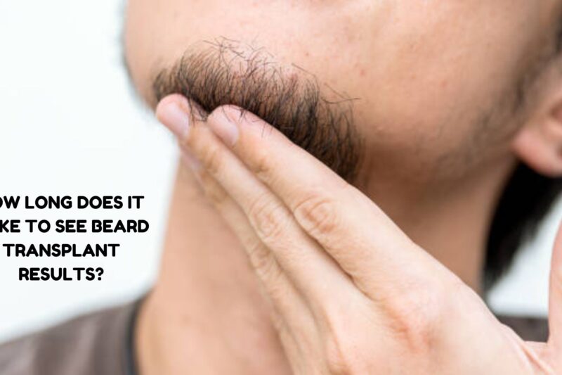 How Long Does It Take to See Beard Transplant Results?