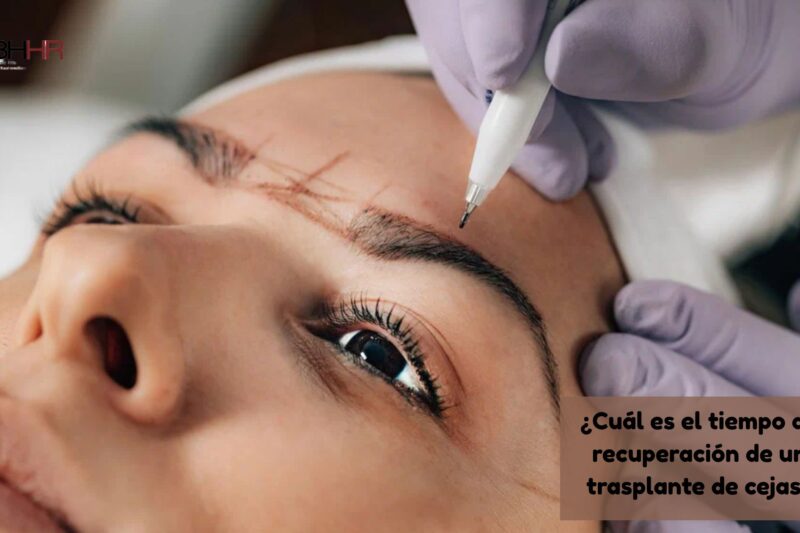 ¿Cuál es el tiempo de recuperación de un trasplante de cejas?